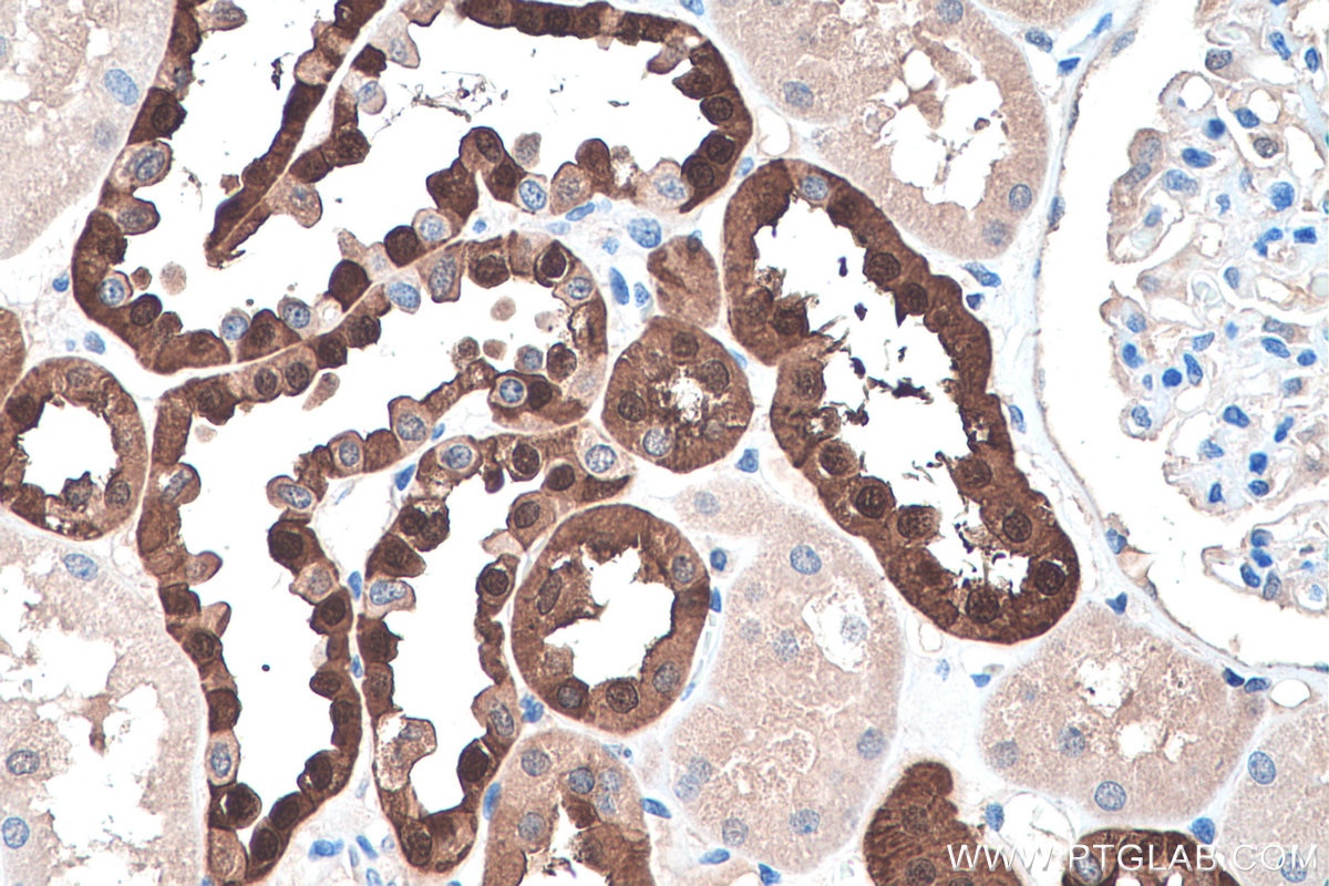 Immunohistochemistry (IHC) staining of human kidney tissue using Calbindin-D28k Polyclonal antibody (14479-1-AP)