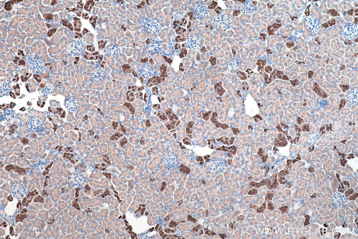 Immunohistochemistry (IHC) staining of mouse kidney tissue using Calbindin-D28k Polyclonal antibody (14479-1-AP)