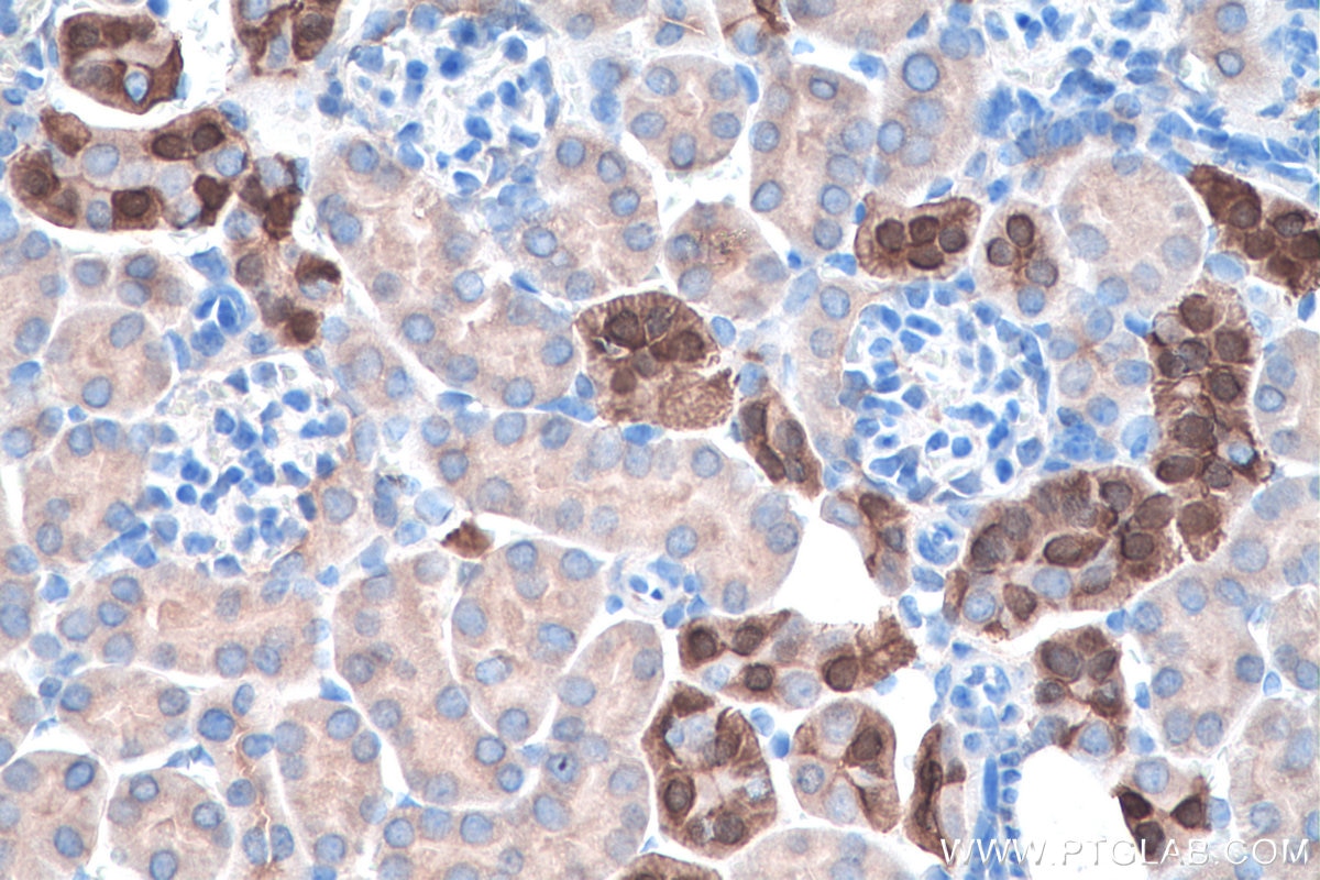 Immunohistochemistry (IHC) staining of mouse kidney tissue using Calbindin-D28k Polyclonal antibody (14479-1-AP)