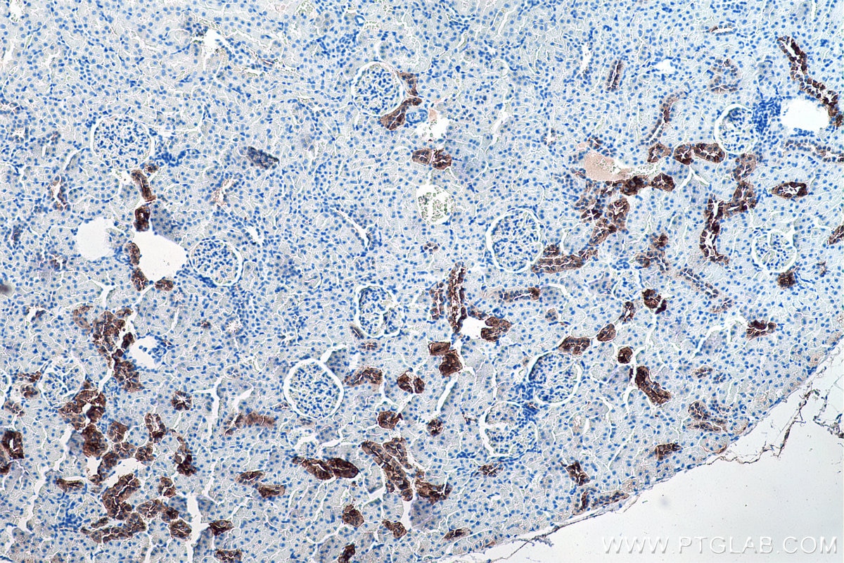 Immunohistochemistry (IHC) staining of rat kidney tissue using Calbindin-D28k Polyclonal antibody (14479-1-AP)