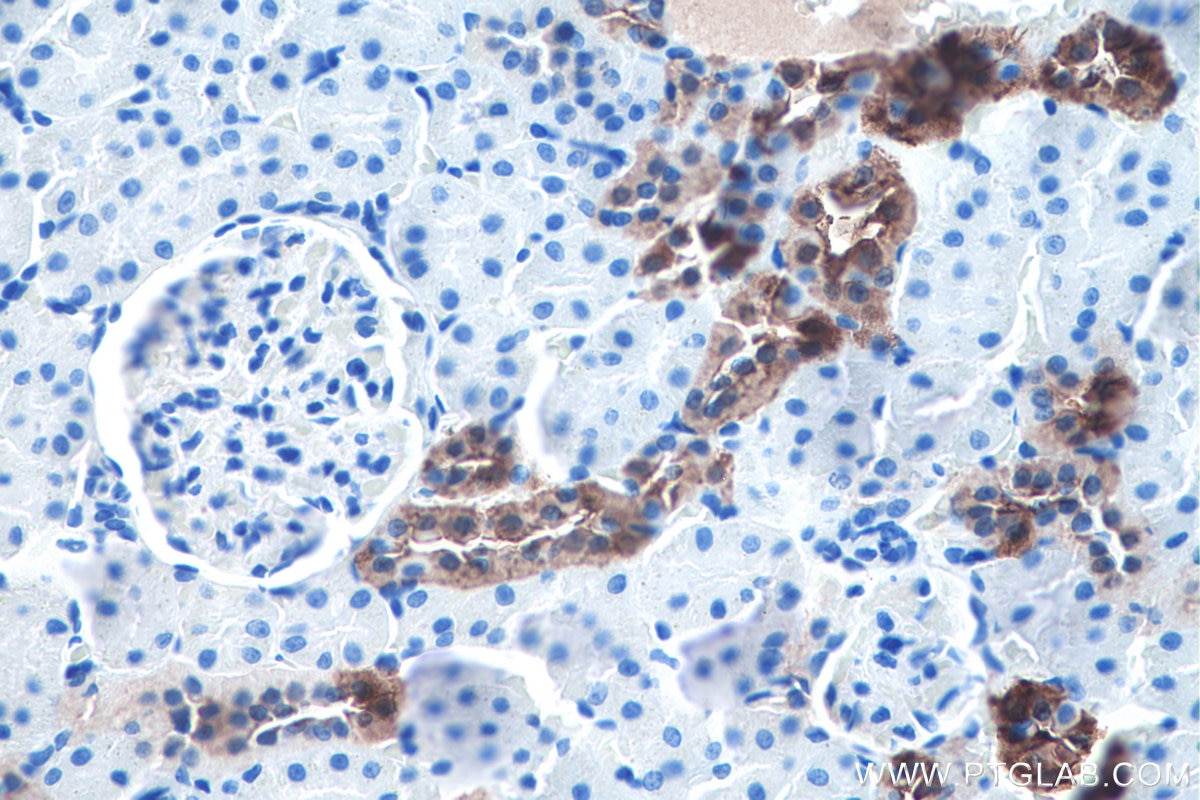 Immunohistochemistry (IHC) staining of rat kidney tissue using Calbindin-D28k Polyclonal antibody (14479-1-AP)