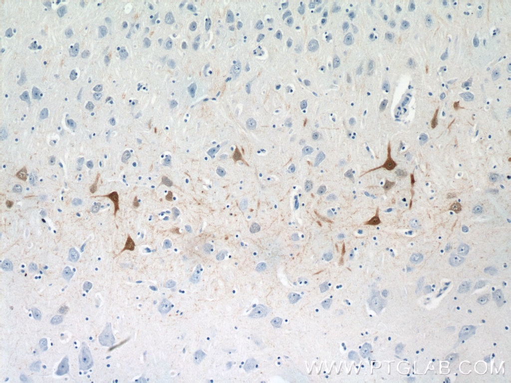 IHC staining of human brain using 14479-1-AP