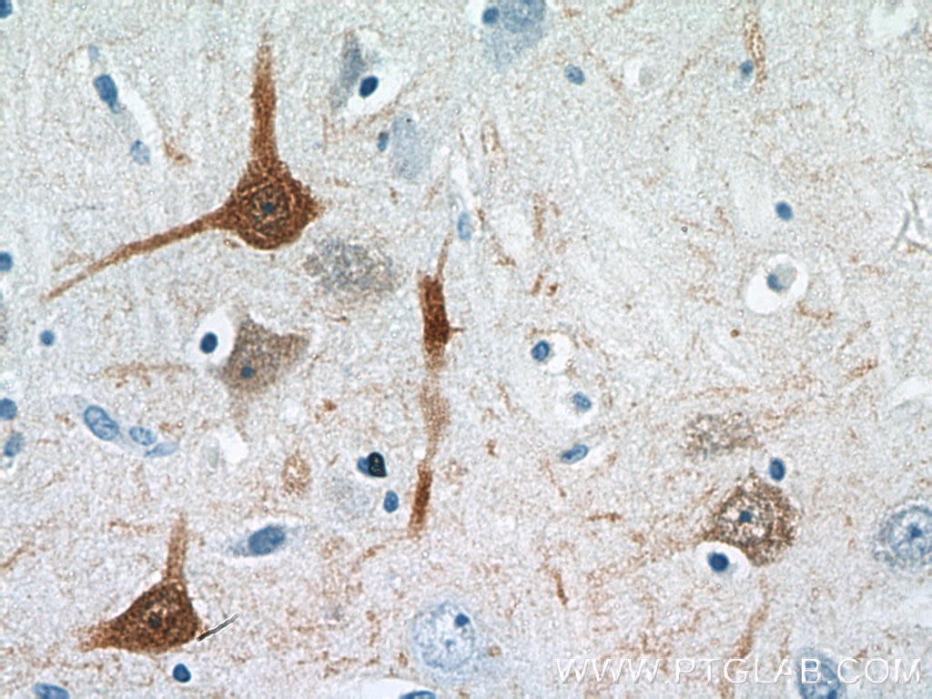 Immunohistochemistry (IHC) staining of human brain tissue using Calbindin-D28k Polyclonal antibody (14479-1-AP)
