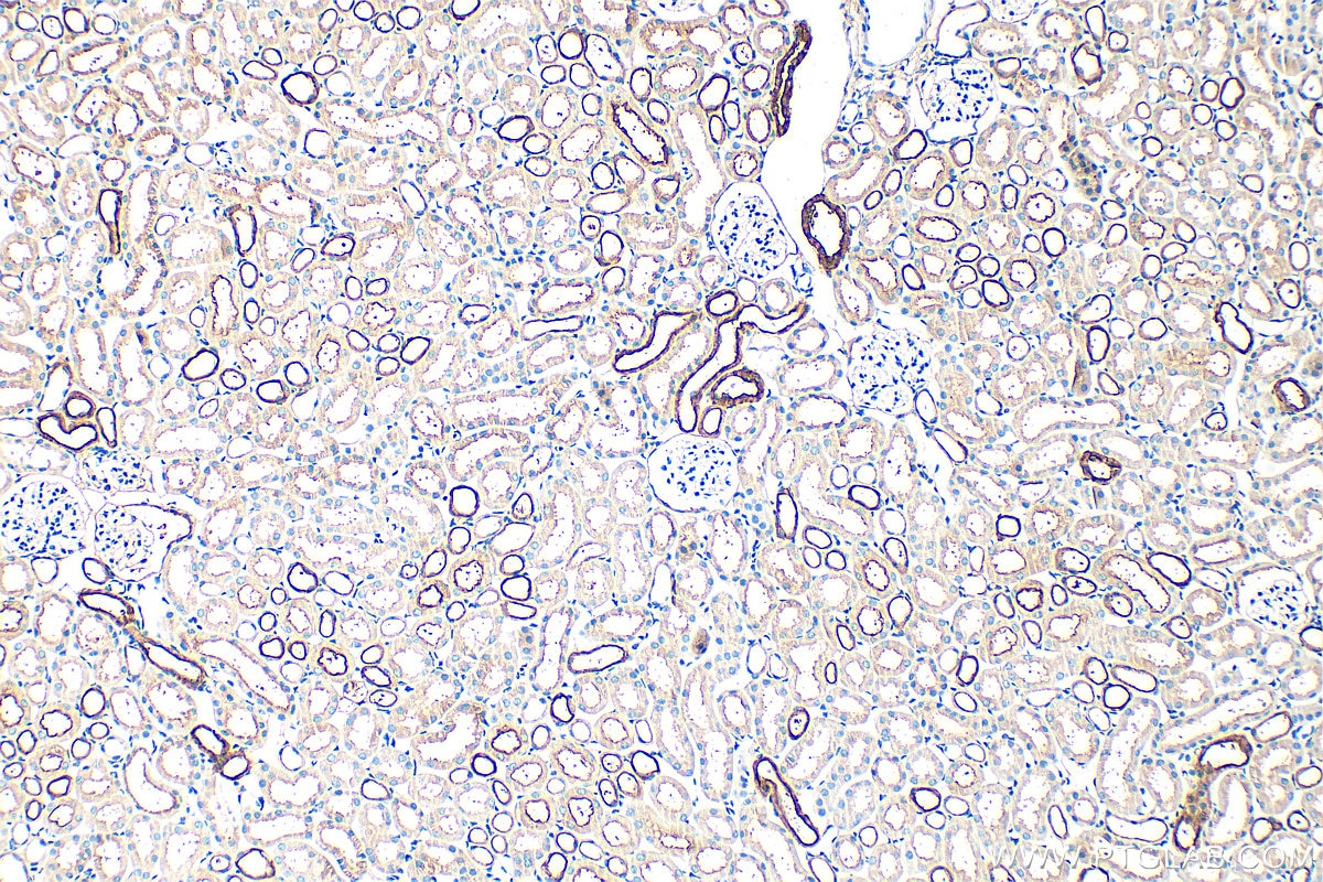 Immunohistochemistry (IHC) staining of mouse kidney tissue using Calbindin-D28k Polyclonal antibody (14479-1-AP)