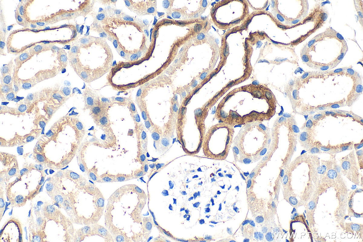 Immunohistochemistry (IHC) staining of mouse kidney tissue using Calbindin-D28k Polyclonal antibody (14479-1-AP)