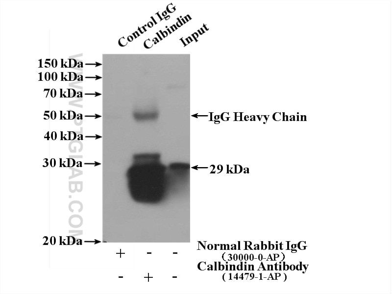 Immunoprecipitation (IP) experiment of mouse brain tissue using Calbindin-D28k Polyclonal antibody (14479-1-AP)