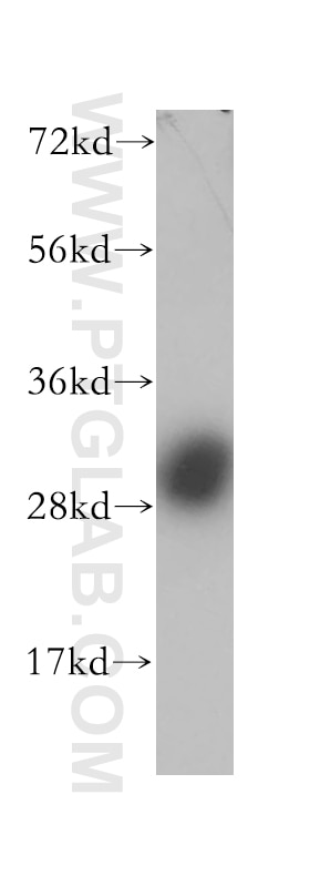 Western Blot (WB) analysis of human kidney tissue using Calbindin-D28k Polyclonal antibody (14479-1-AP)