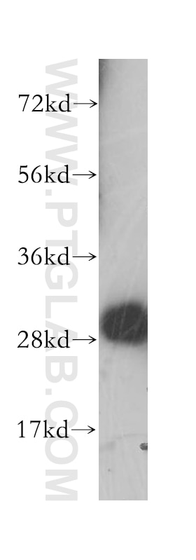 Western Blot (WB) analysis of human brain tissue using Calbindin-D28k Polyclonal antibody (14479-1-AP)