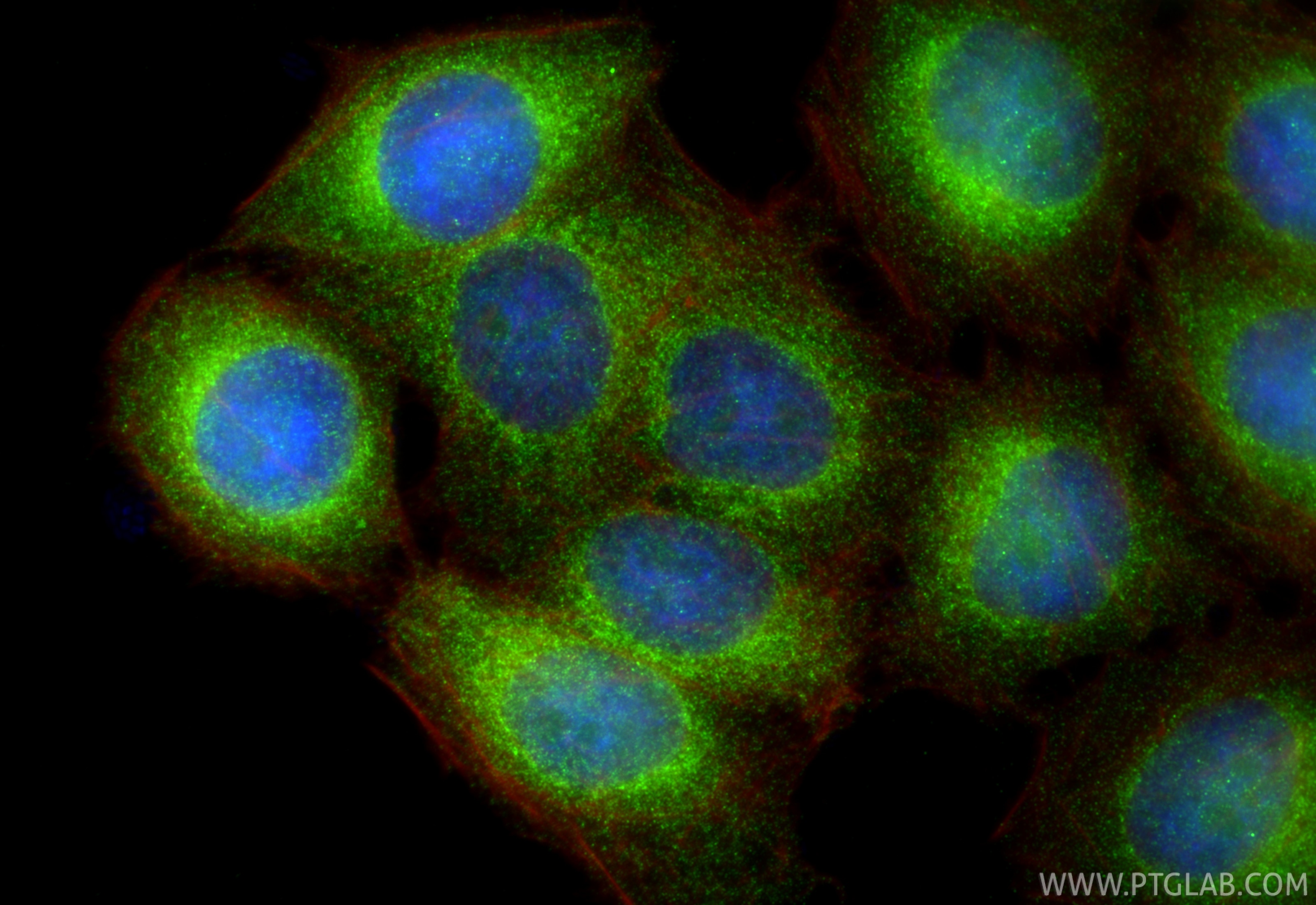 Immunofluorescence (IF) / fluorescent staining of MKN-45 cells using Calretinin Polyclonal antibody (12278-1-AP)
