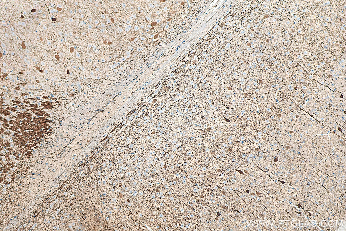 Immunohistochemistry (IHC) staining of mouse brain tissue using Calretinin Polyclonal antibody (12278-1-AP)