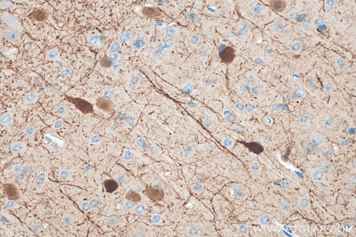 Immunohistochemistry (IHC) staining of mouse brain tissue using Calretinin Polyclonal antibody (12278-1-AP)