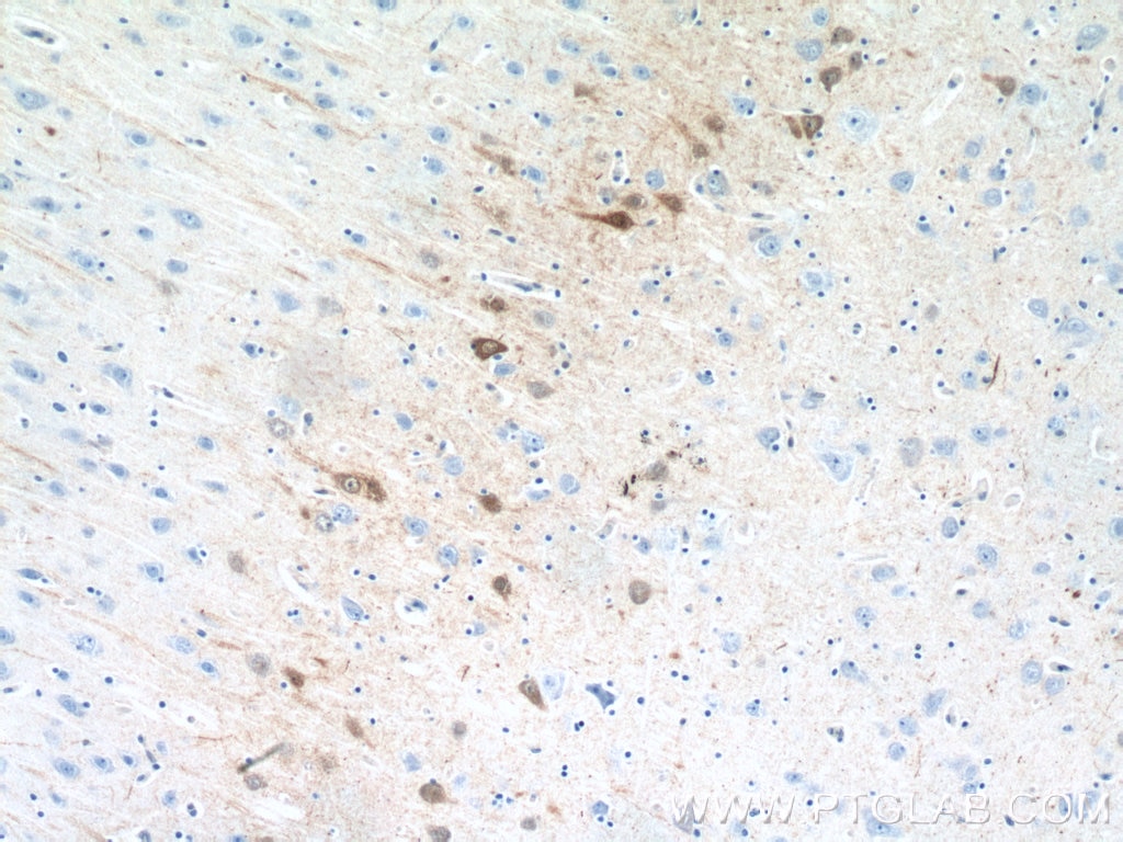 Immunohistochemistry (IHC) staining of human brain tissue using Calretinin Polyclonal antibody (12278-1-AP)