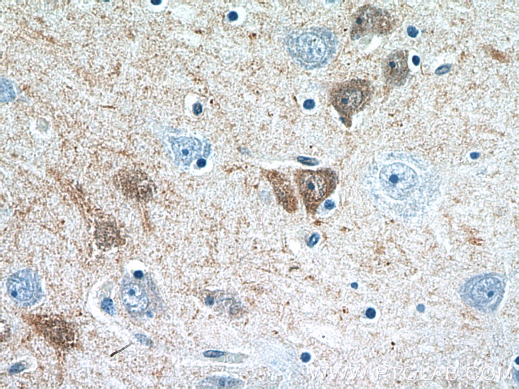 Immunohistochemistry (IHC) staining of human brain tissue using Calretinin Polyclonal antibody (12278-1-AP)