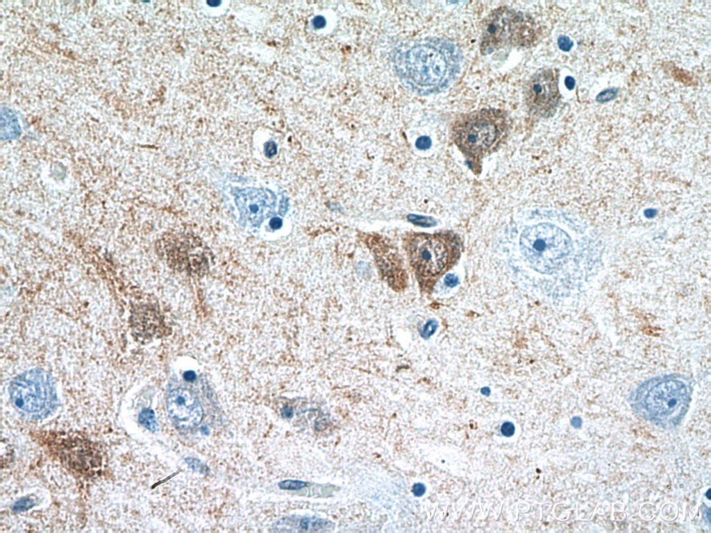 IHC staining of human brain using 12278-1-AP