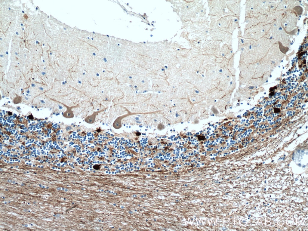 Immunohistochemistry (IHC) staining of human cerebellum tissue using Calretinin Polyclonal antibody (12278-1-AP)