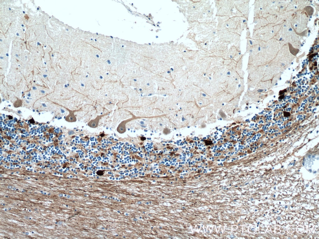 IHC staining of human cerebellum using 12278-1-AP