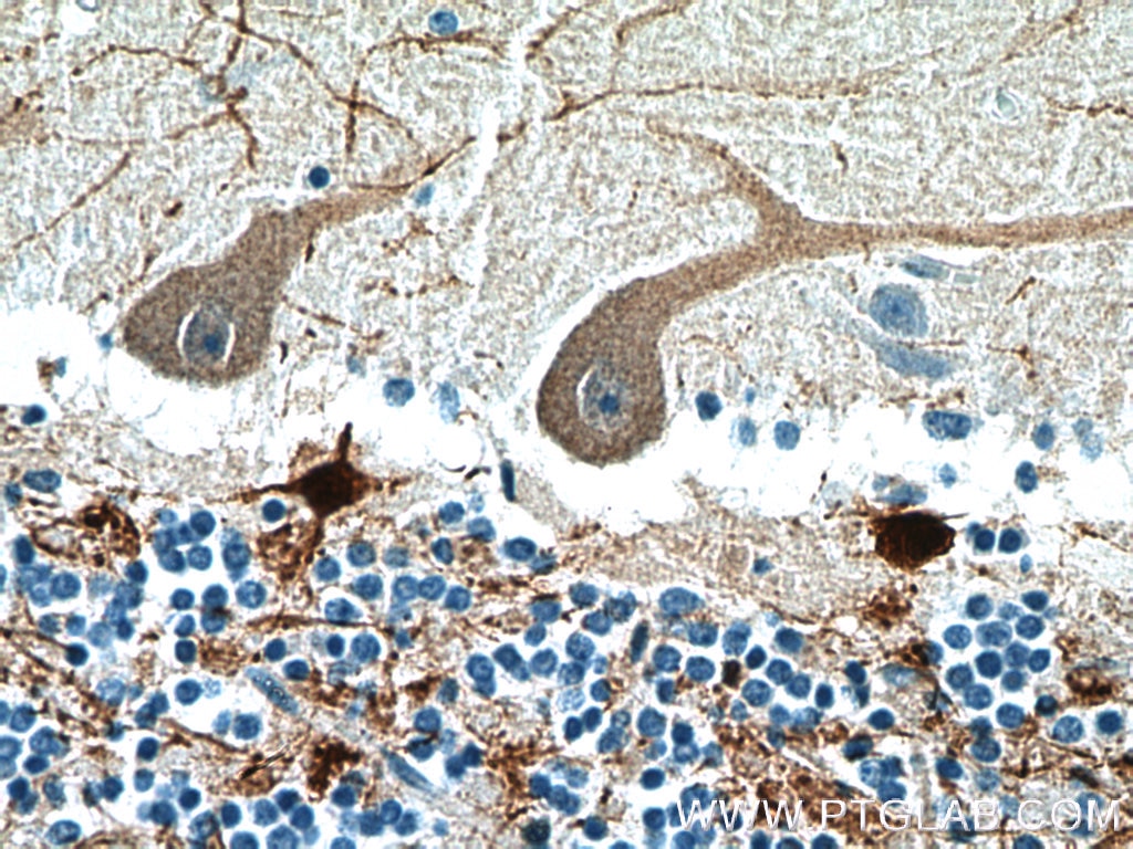 IHC staining of human cerebellum using 12278-1-AP