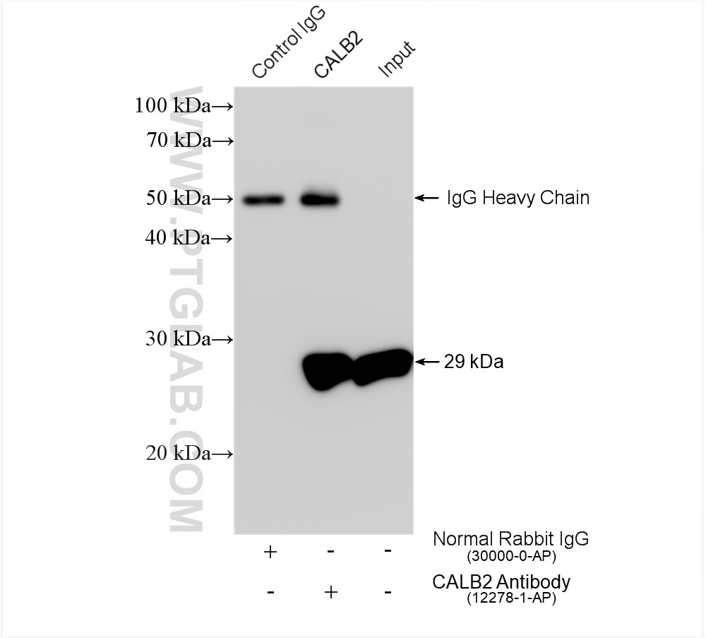 Immunoprecipitation (IP) experiment of mouse brain tissue using Calretinin Polyclonal antibody (12278-1-AP)