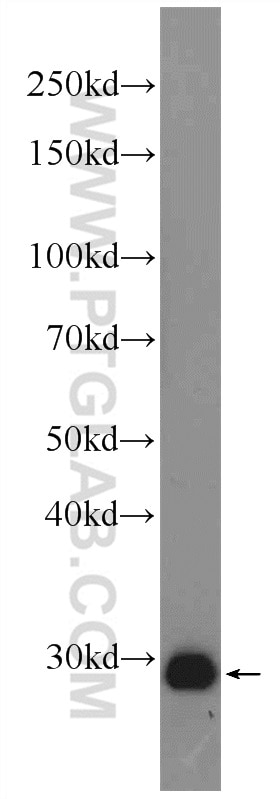 Western Blot (WB) analysis of fetal human brain tissue using Calretinin Polyclonal antibody (12278-1-AP)