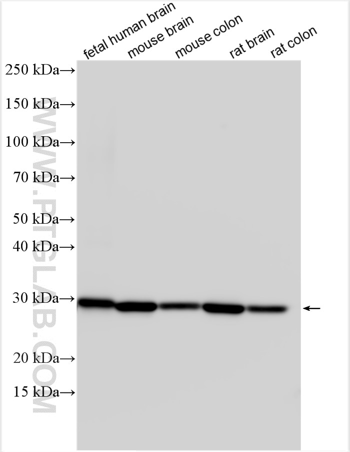 Western Blot (WB) analysis of various lysates using Calretinin Polyclonal antibody (12278-1-AP)