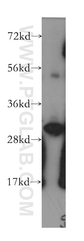 Western Blot (WB) analysis of human ileum tissue using Calretinin Polyclonal antibody (12278-1-AP)