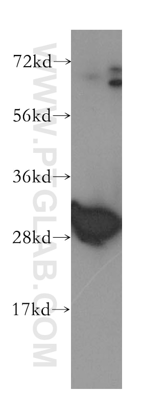 Western Blot (WB) analysis of human brain tissue using Calretinin Polyclonal antibody (12278-1-AP)