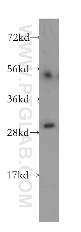 Western Blot (WB) analysis of human colon tissue using Calretinin Polyclonal antibody (12278-1-AP)