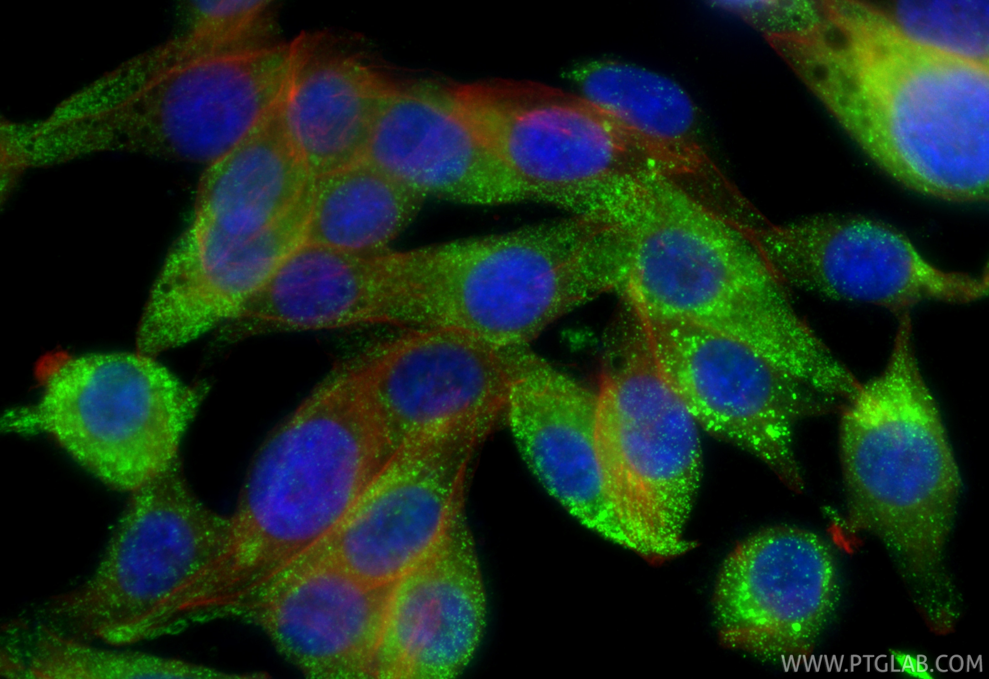 Immunofluorescence (IF) / fluorescent staining of TT cells using CALCA/Calcitonin Polyclonal antibody (22244-1-AP)