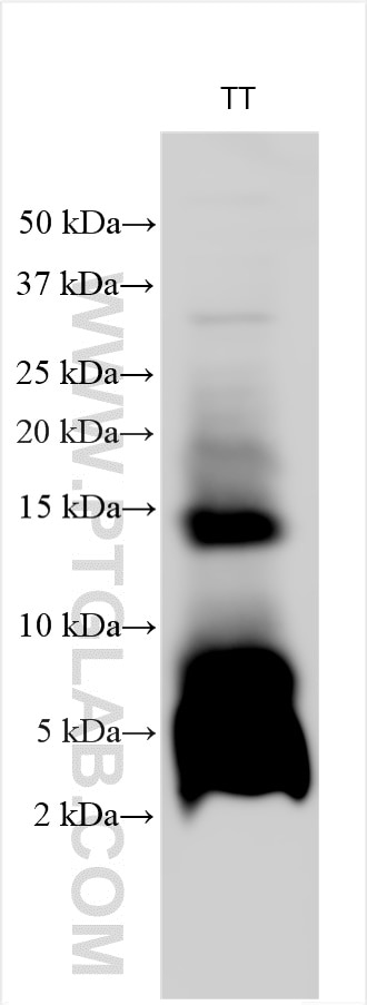Western Blot (WB) analysis of various lysates using CALCA/CGRP Polyclonal antibody (22244-1-AP)