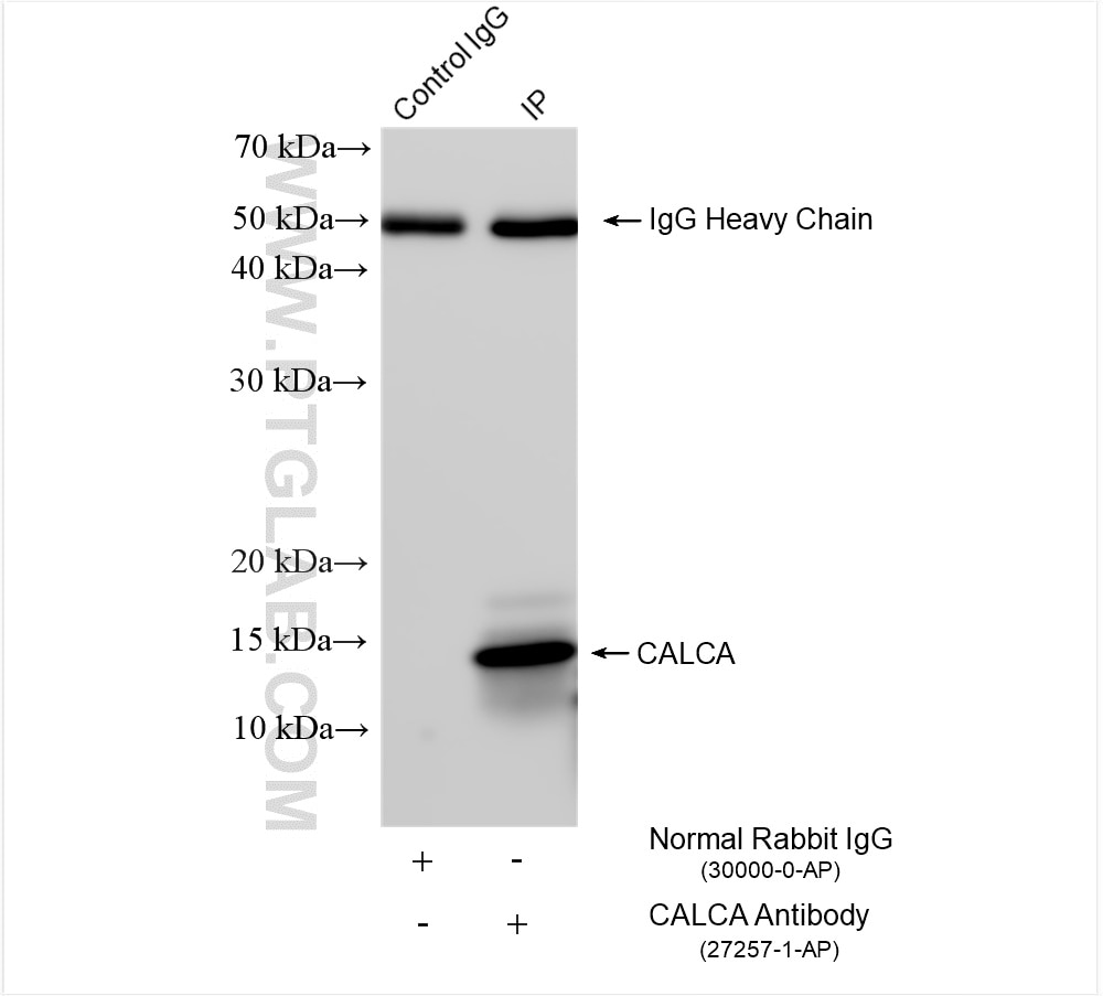 Immunoprecipitation (IP) experiment of TT cells using CALCA/CGRP Polyclonal antibody (27257-1-AP)