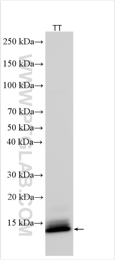 CALCA/Calcitonin
