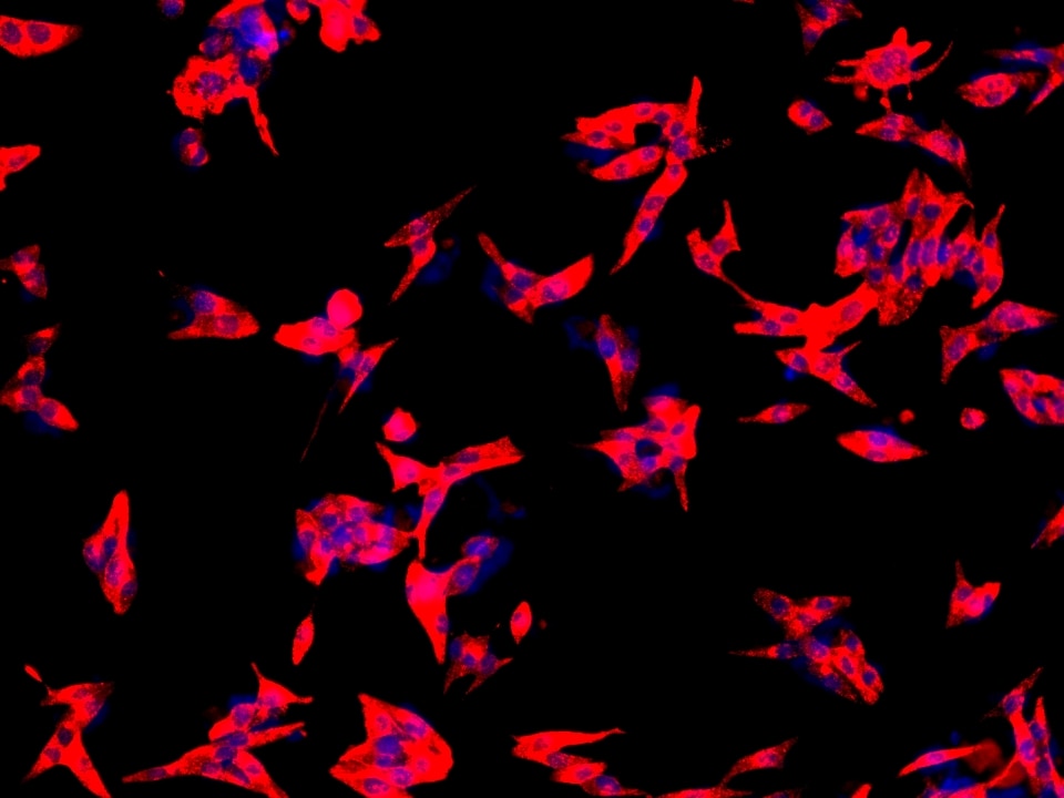 CALCA/CGRP