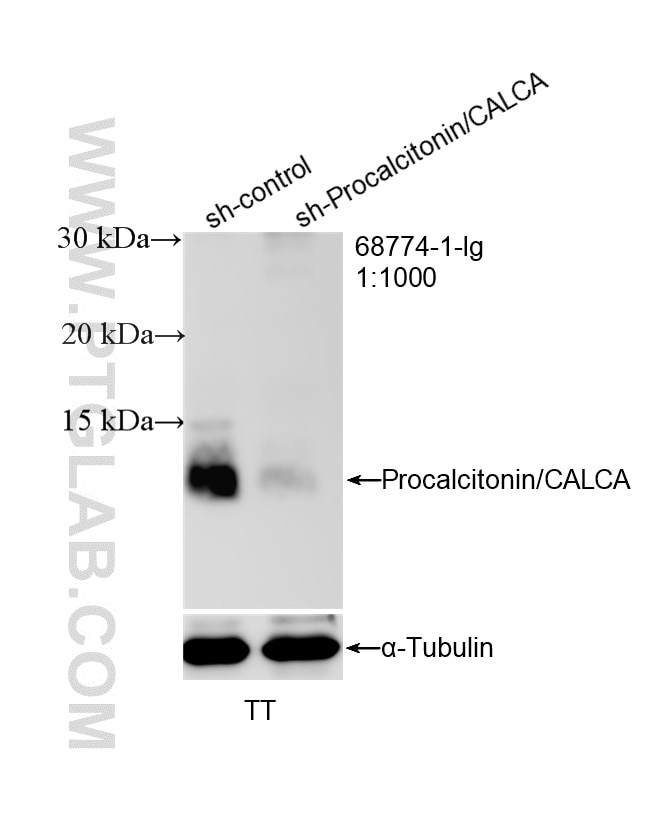 Western Blot (WB) analysis of TT cells using CALCA/Calcitonin Monoclonal antibody (68774-1-Ig)