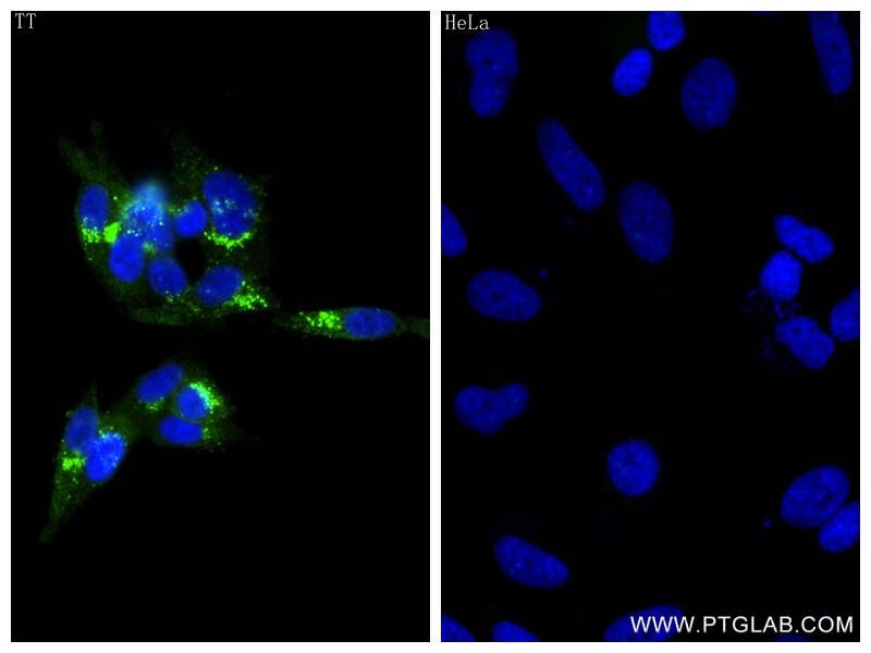 Immunofluorescence (IF) / fluorescent staining of TT cells using CALCA/Calcitonin Recombinant antibody (83774-1-RR)