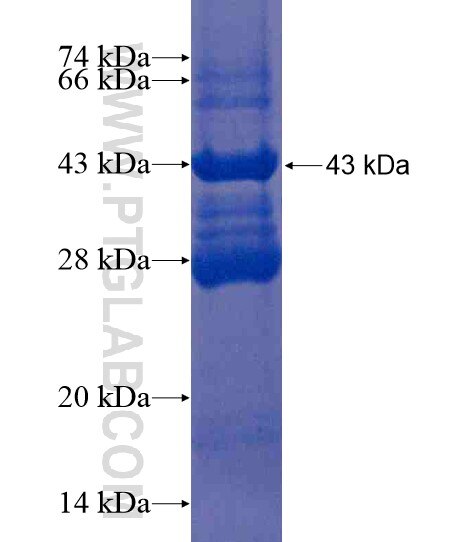 CALCA fusion protein Ag21503 SDS-PAGE CALCA fusion protein Ag21503 SDS-PAGE