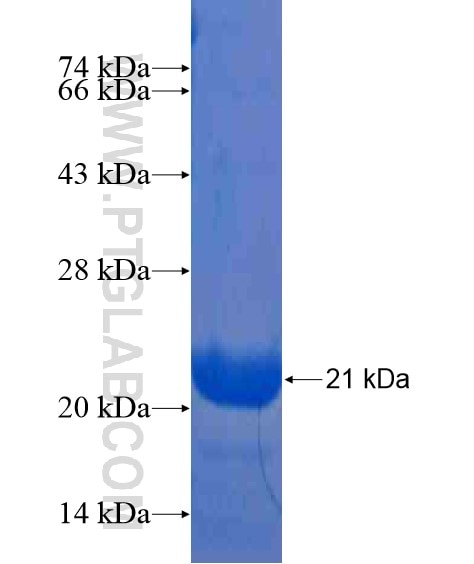 CALCA fusion protein Ag21507 SDS-PAGE