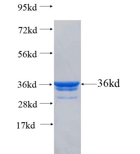 CALCA fusion protein Ag26133 SDS-PAGE