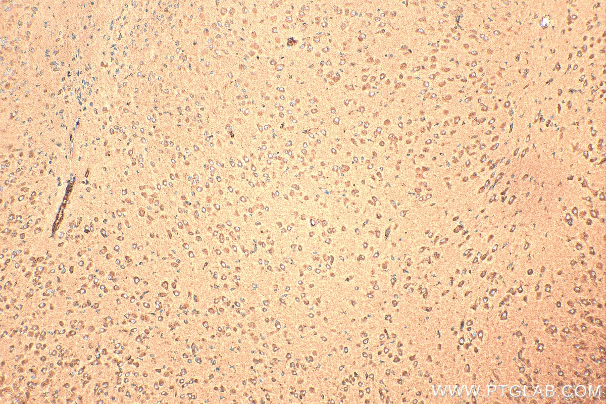 Immunohistochemistry (IHC) staining of mouse brain tissue using CALCB Polyclonal antibody (23890-1-AP)