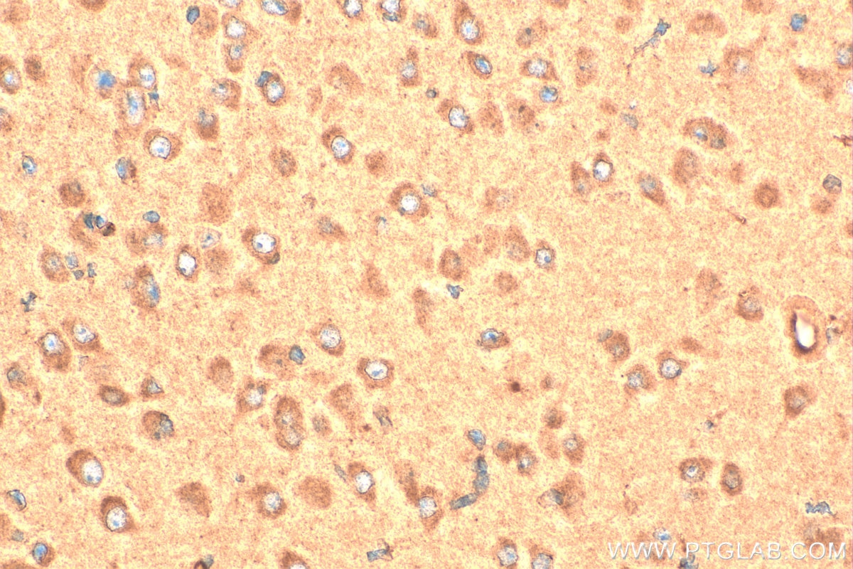 Immunohistochemistry (IHC) staining of mouse brain tissue using CALCB Polyclonal antibody (23890-1-AP)