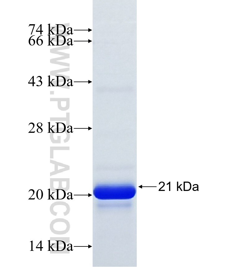 CALCB fusion protein Ag20926 SDS-PAGE