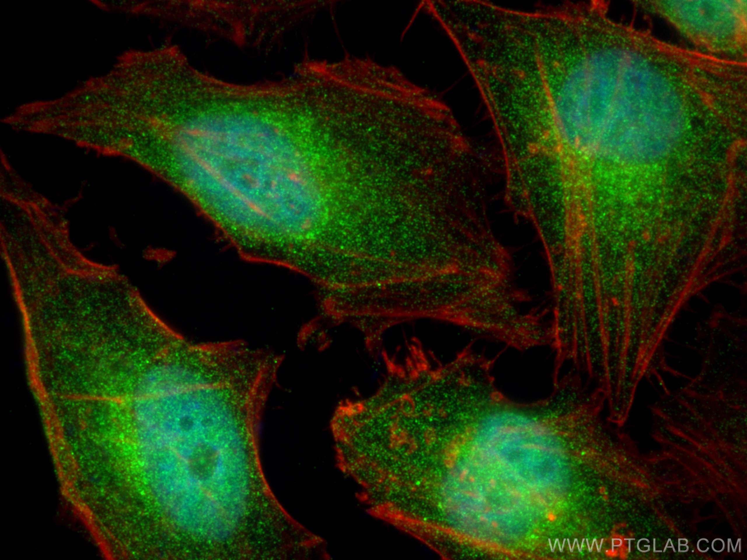 Immunofluorescence (IF) / fluorescent staining of HeLa cells using CALCOCO1 Polyclonal antibody (19843-1-AP)