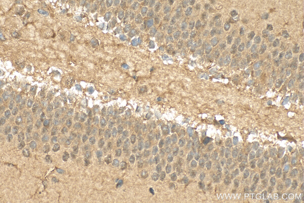 Immunohistochemistry (IHC) staining of mouse brain tissue using CALCOCO1 Polyclonal antibody (19843-1-AP)