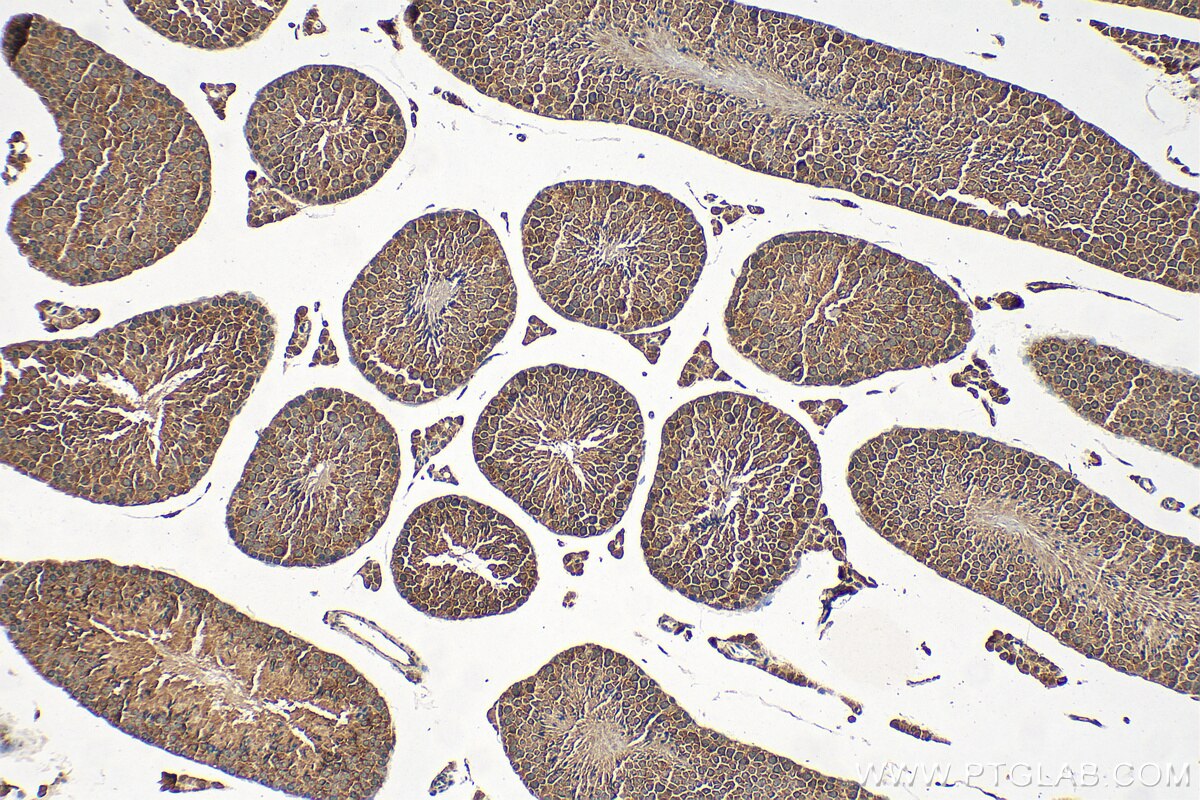 Immunohistochemistry (IHC) staining of mouse testis tissue using CALCOCO1 Polyclonal antibody (19843-1-AP)