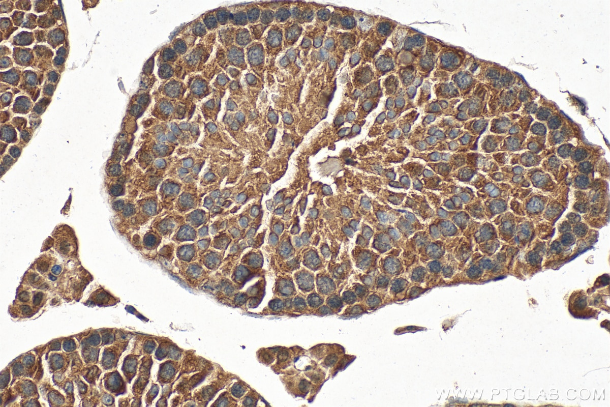 Immunohistochemistry (IHC) staining of mouse testis tissue using CALCOCO1 Polyclonal antibody (19843-1-AP)