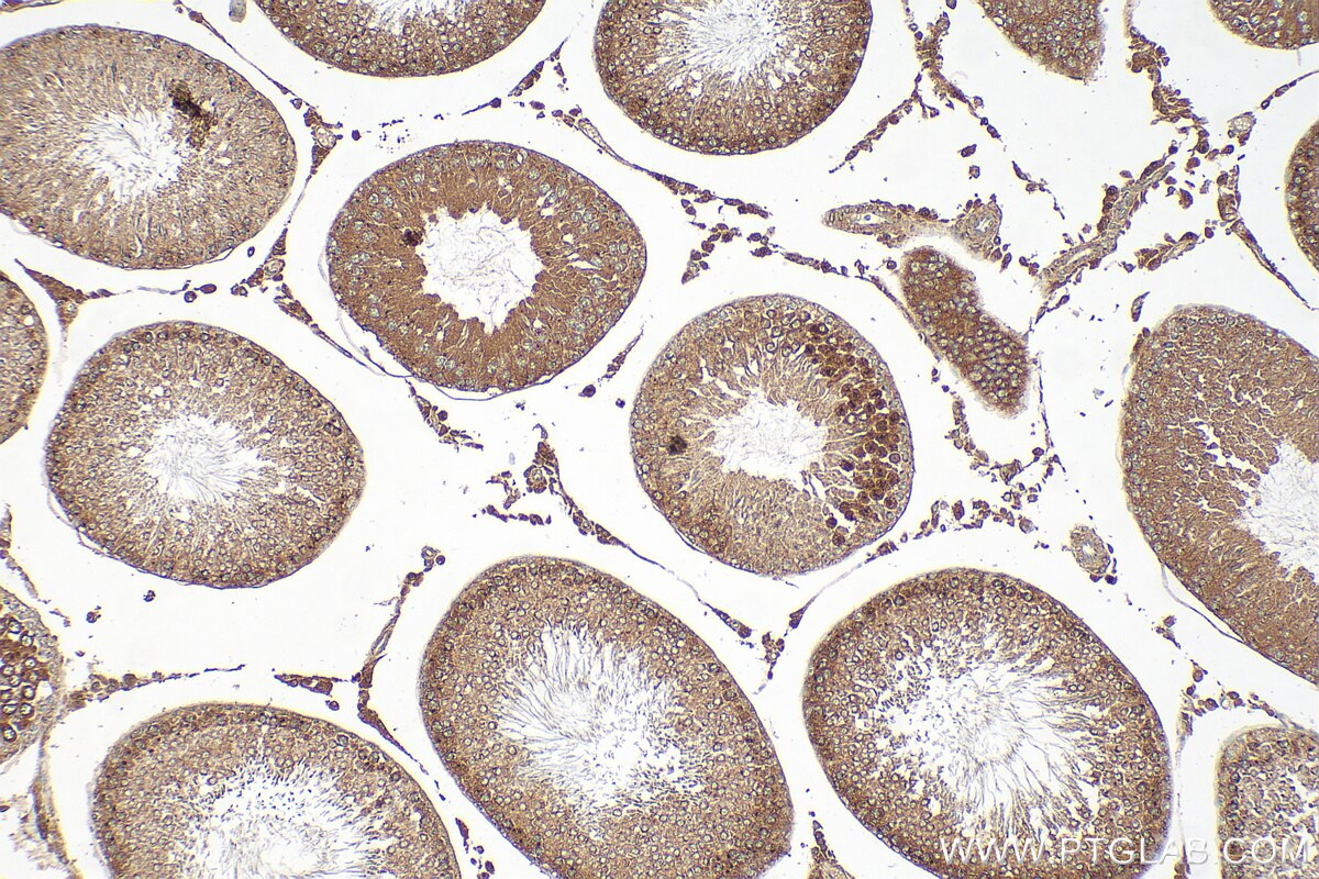 Immunohistochemistry (IHC) staining of rat testis tissue using CALCOCO1 Polyclonal antibody (19843-1-AP)