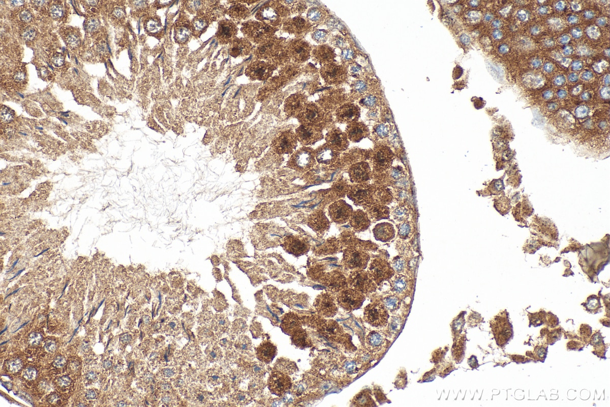 Immunohistochemistry (IHC) staining of rat testis tissue using CALCOCO1 Polyclonal antibody (19843-1-AP)