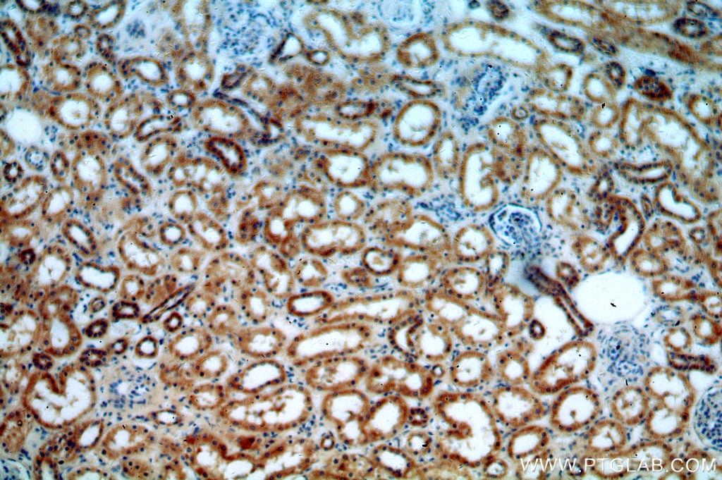 Immunohistochemistry (IHC) staining of human kidney tissue using CALCOCO1 Polyclonal antibody (19843-1-AP)