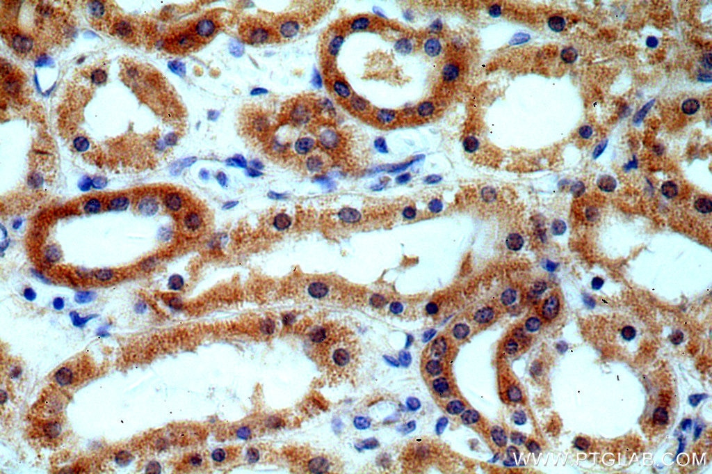Immunohistochemistry (IHC) staining of human kidney tissue using CALCOCO1 Polyclonal antibody (19843-1-AP)