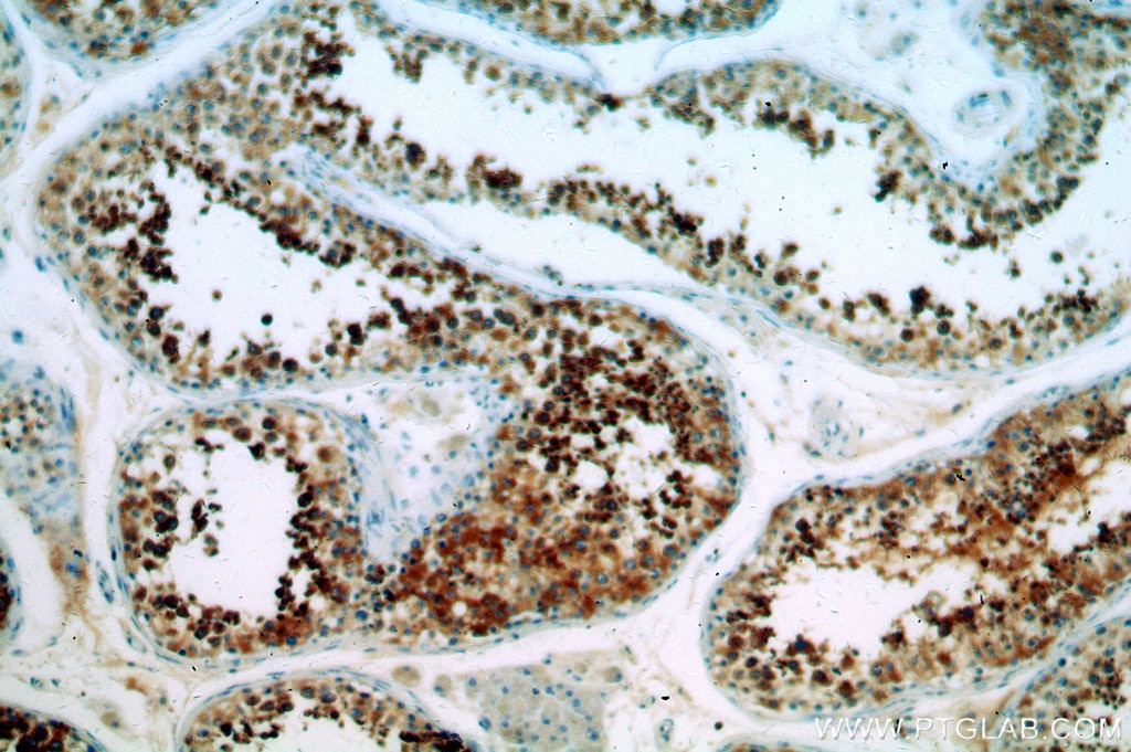 Immunohistochemistry (IHC) staining of human testis tissue using CALCOCO1 Polyclonal antibody (19843-1-AP)