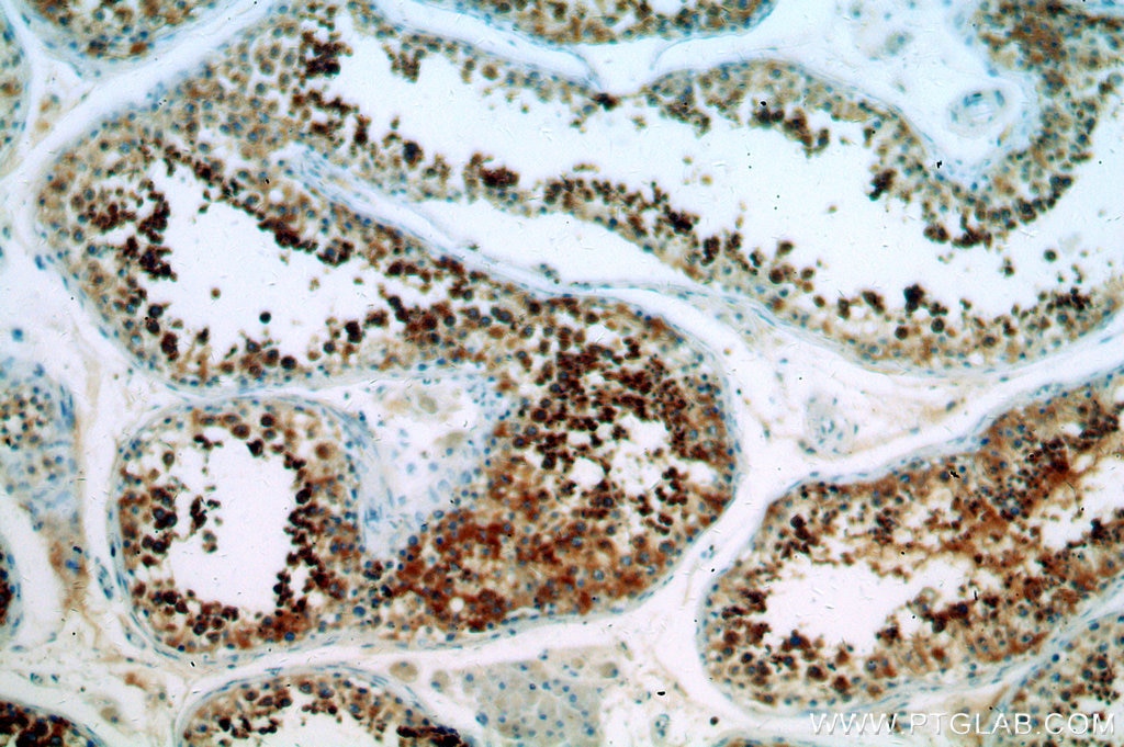 IHC staining of human testis using 19843-1-AP